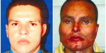 El Chupeta: El narcogalán colombiano que quedó desfigurado y testificó contra El Chapo