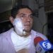 Apuñalan a comerciante de la Central de Abastos en Iztapalapa | VIDEO