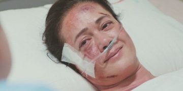 Mujer muere en cirugía estética en Edomex; los médicos se dieron a la fuga