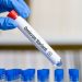 Por variante Ómicron retroceden en semáforo epidemiológico 10 estados