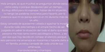 Sam Barrios: Fiscalía de Guanajuato busca a la expareja de la influencer tras denuncia de agresiones físicas