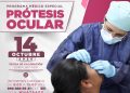 DIF Benito Juárez fortalece programa de prótesis oculares gratuitas